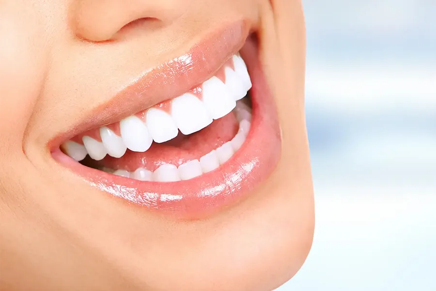 Hollywood Smile