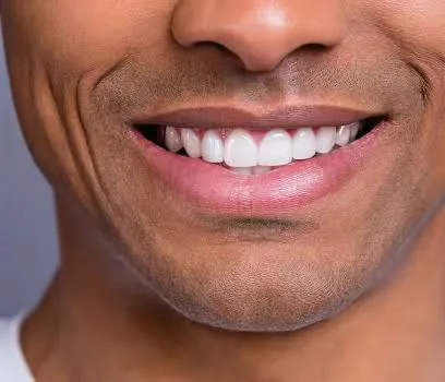 Teeth Whitening