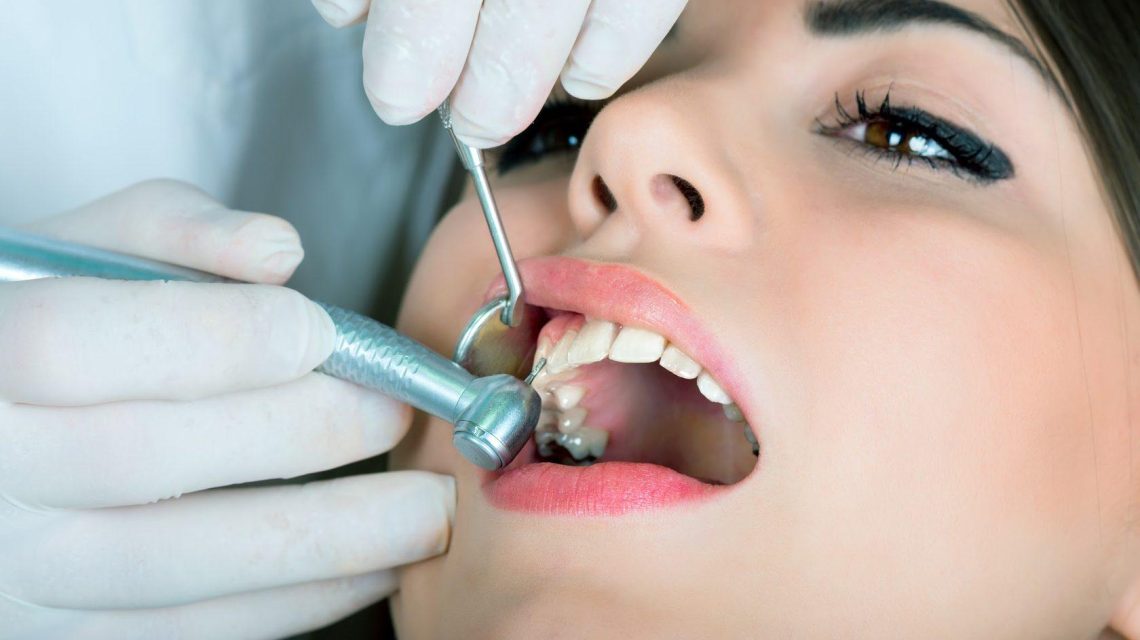 Что такое пломбирование зубов?"