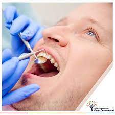 "Уход за зубными пломбами"