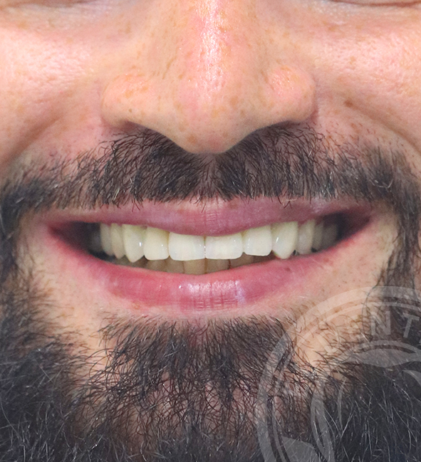 your dental care